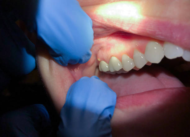 Best Emergency Orthodontic Services in Ozk, AR